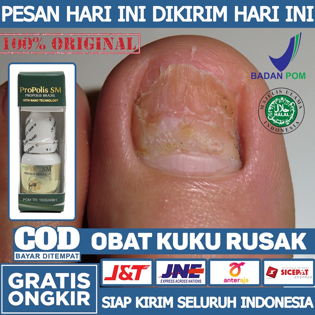 Jual Obat Kuku Rusak Obat Kuku Mati Obat Kuku Kering Obat Kuku