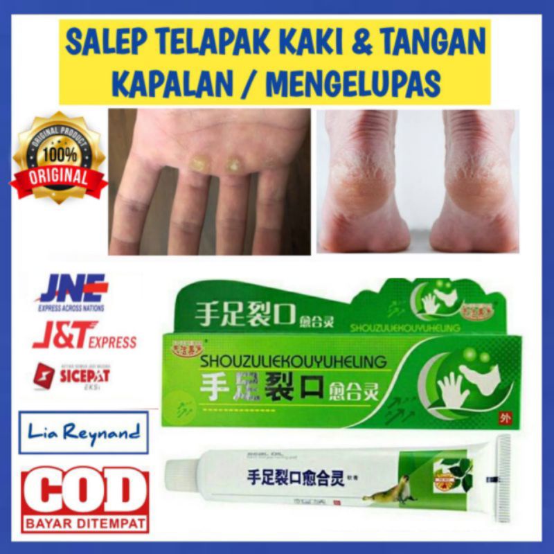 Kapalan Telapak Kaki Homecare24