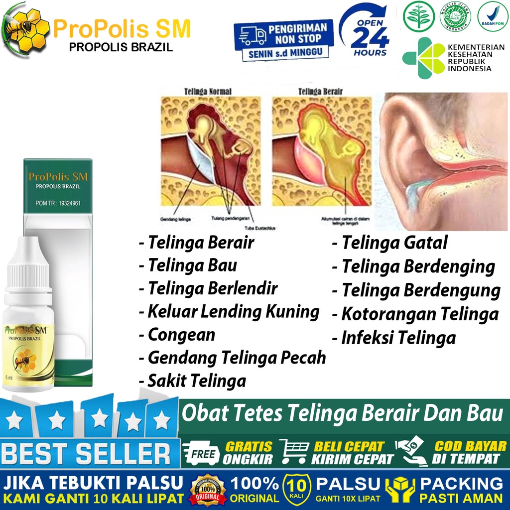 Jual Obat Tetes Telinga Berair Berlendir Kuning Berbau Congek Sakit