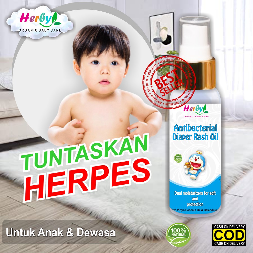 Jual Obat Biang Keringat Scabies Herpes Gatal Dermatitis Eksim Alergi