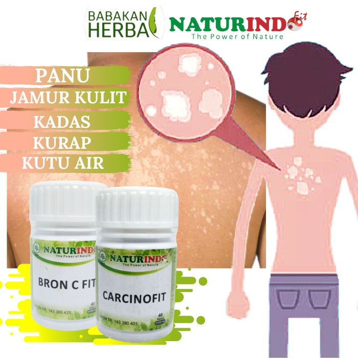 Jual Naturindo Obat Penyakit Kulit Menahun Herbal Jamur Kulit Obat Panu