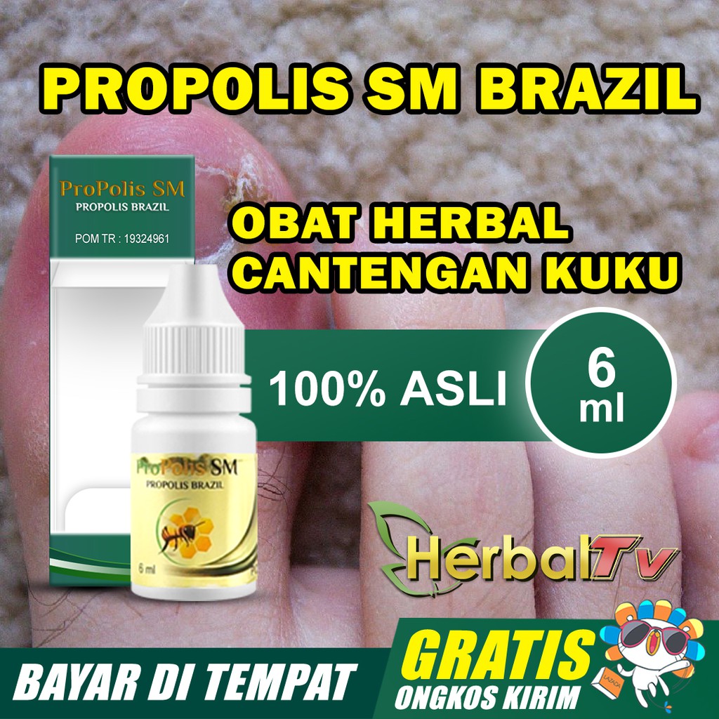 Jual Propolis Obat Cantengan Di Jempol Kaki Cantengan Parah Bengkak Dan