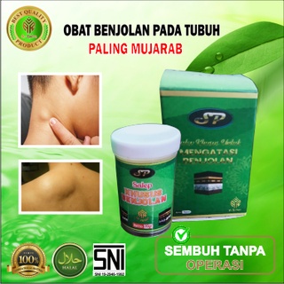 Jual SALEP KHUSUS BENJOLAN AR RAIHAN MENGOBATI BENJOLAN KISTA