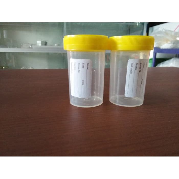 Jual Pot Urin Urine Container Non Sterile Yellow Ml Merk Aviamed