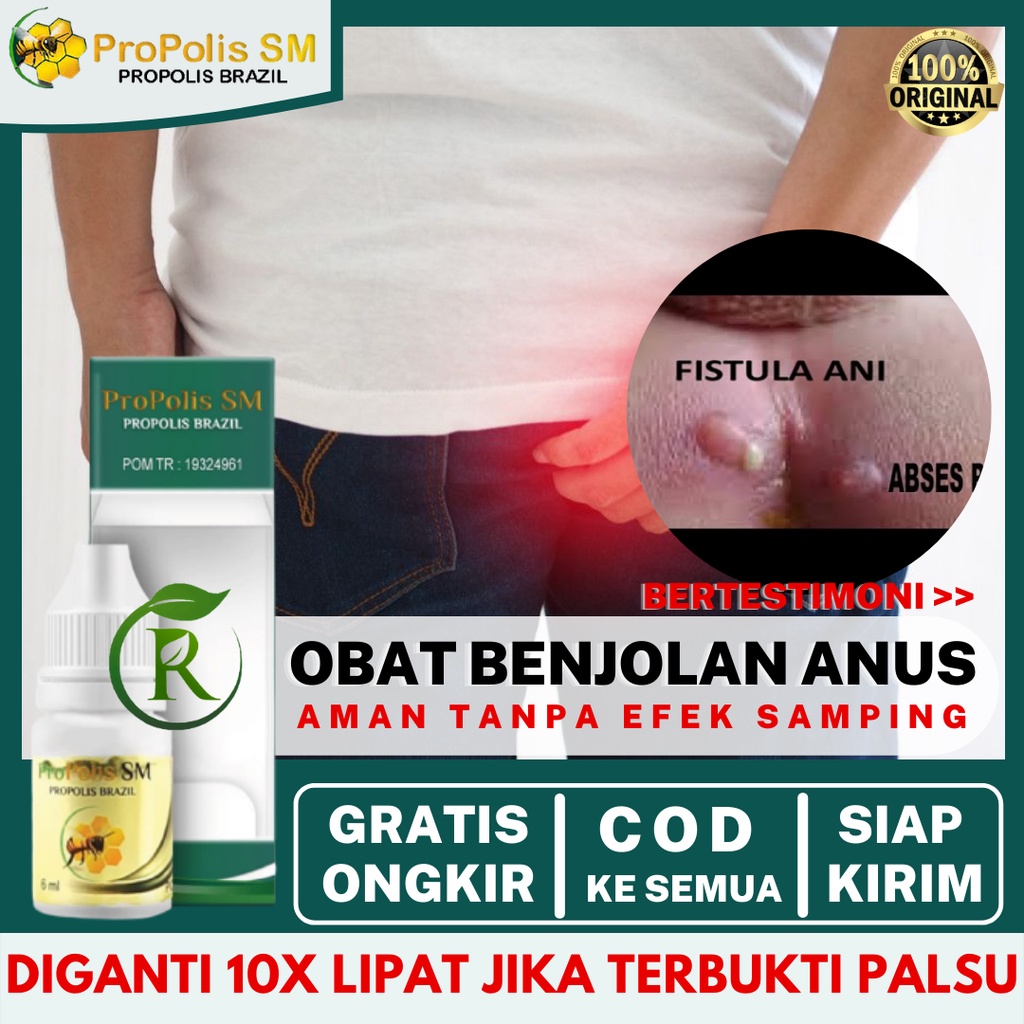 Jual Obat Benjolan Di Anus Anus Keluar Anus Bengkak Anus Sakit