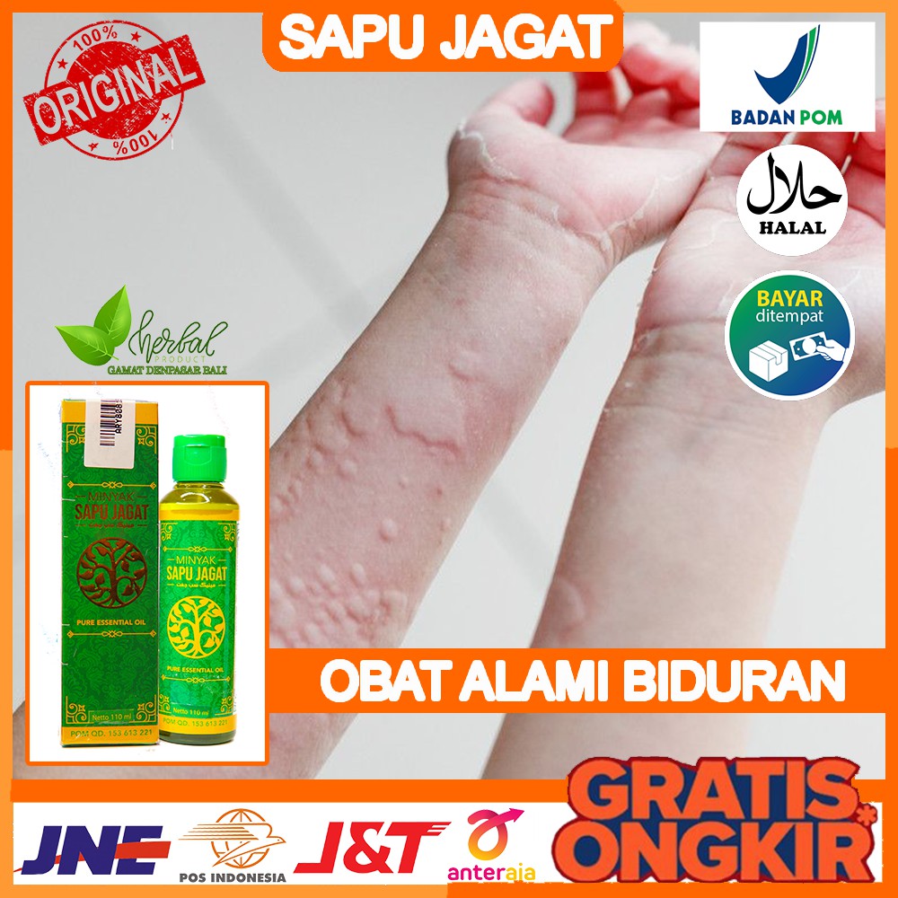 Jual Obat Biduran Penyakit Kulit Eksim Ruam Merah Alergi Kulit