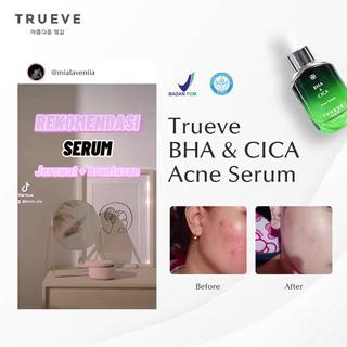 Jual TRUEVE Acne Care Treatment Serum BHA CICA Acne Serum 30 ML