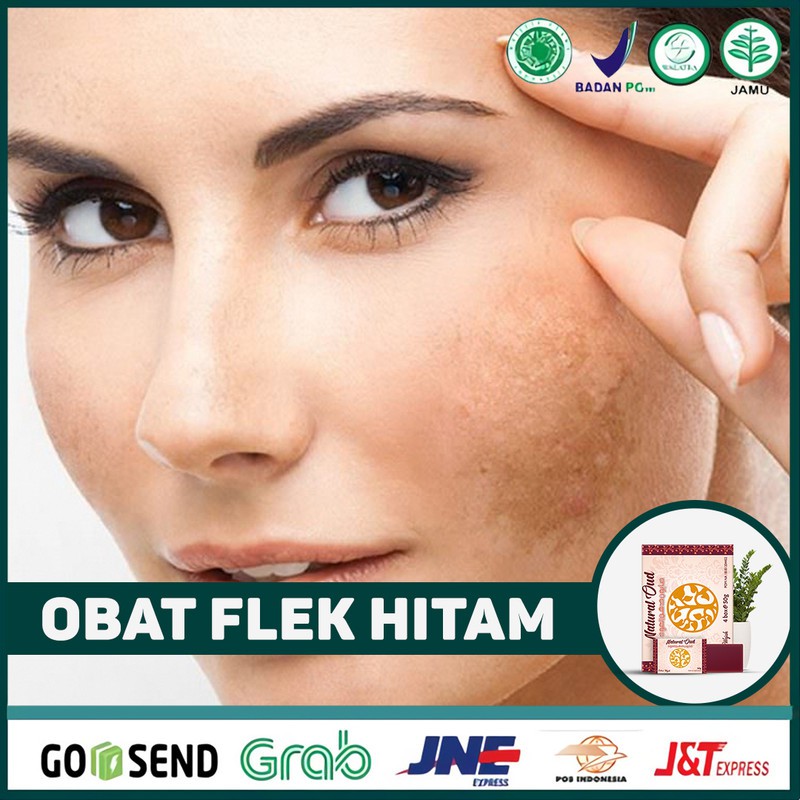 Jual Obat Flek Hitam Wajah Membersihkan Kulit Jerawat Komedo Wajah