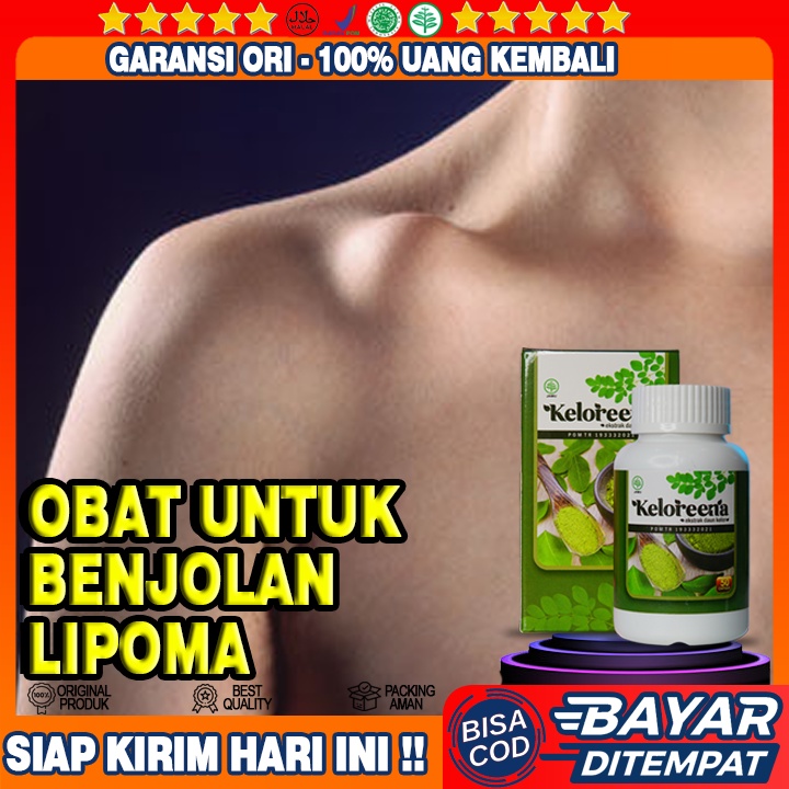 Jual Obat Benjolan Lipoma Penghilang Lipoma Pengempis Lipoma Kapsul