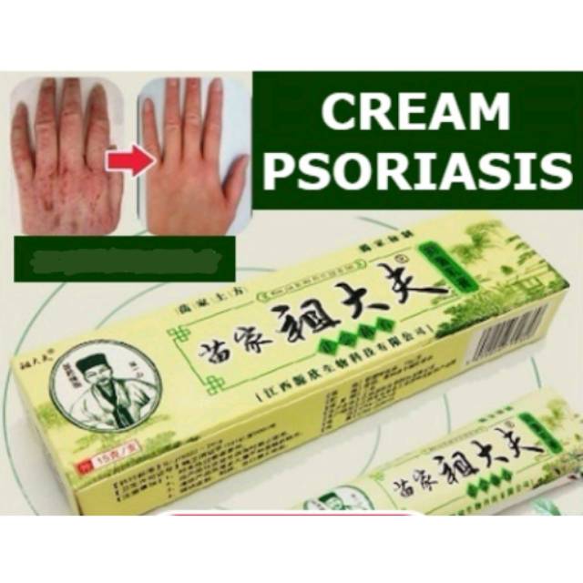 Jual Zudaifu Psoriasis Cream 100 Original Shopee Indonesia