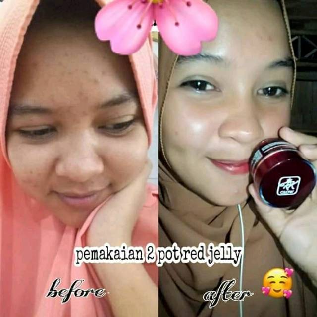 Jual Ecer Rk Red Jelly Skinbooster Vitamin Wajah Bikin Glowing