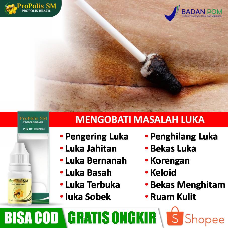 Jual Obat Pengering Luka Jahitan Bekas Operasi Sesar Penghilang Luka