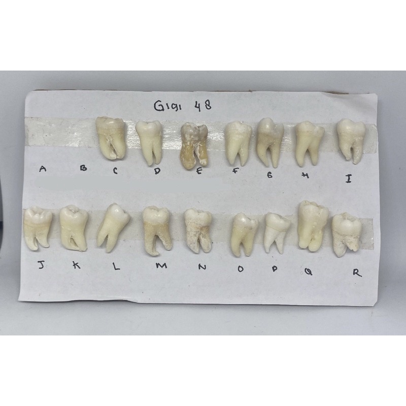 Jual Gigi Molar Rahang Bawah Indonesia Shopee Indonesia