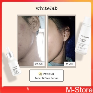 Jual Whitelab Brightening Face Toner Shopee Indonesia