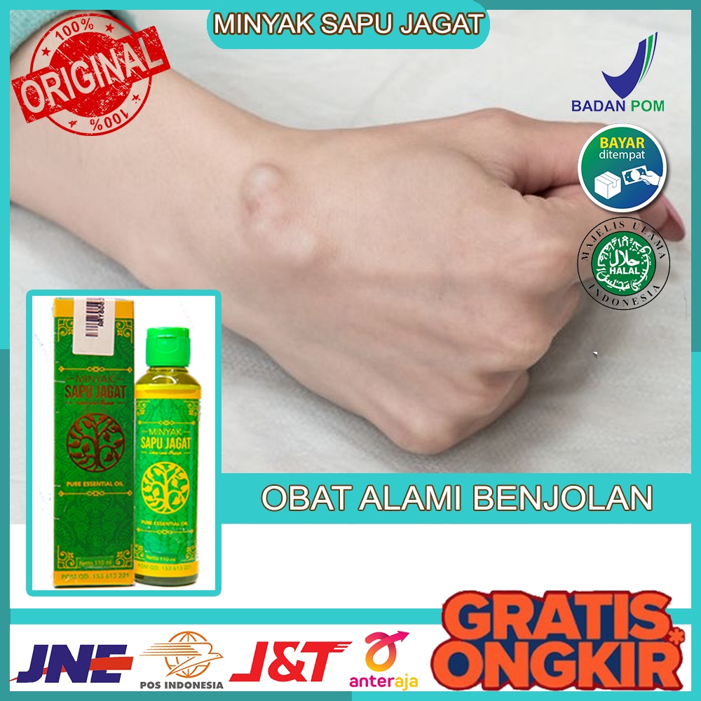 Jual Obat Alami Benjolan Penghilang Benjolan Mrngobati Benjolan