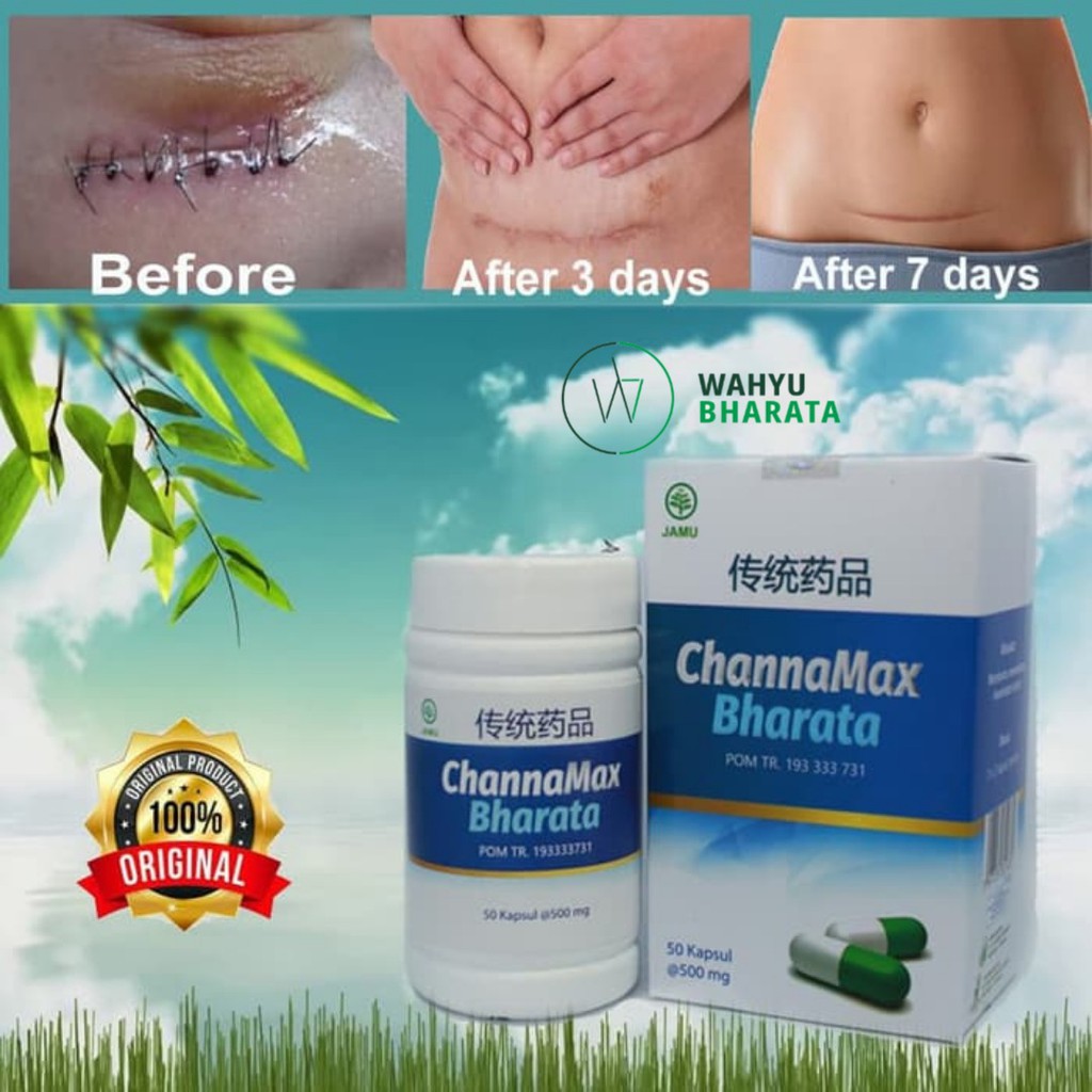 Jual Obat Herbal Channamax Bharata Ampuh Hilangkan Bekas Jahitan