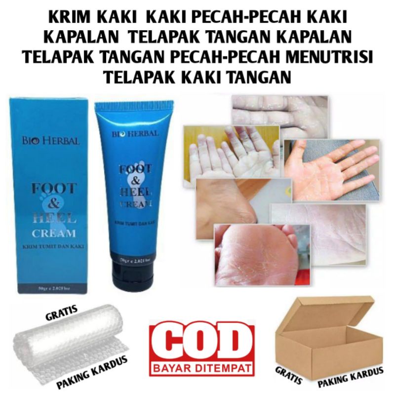 Jual Krim Kaki Kaki Pecah Pecah Kaki Kapalan Telapak Tangan Kapalan