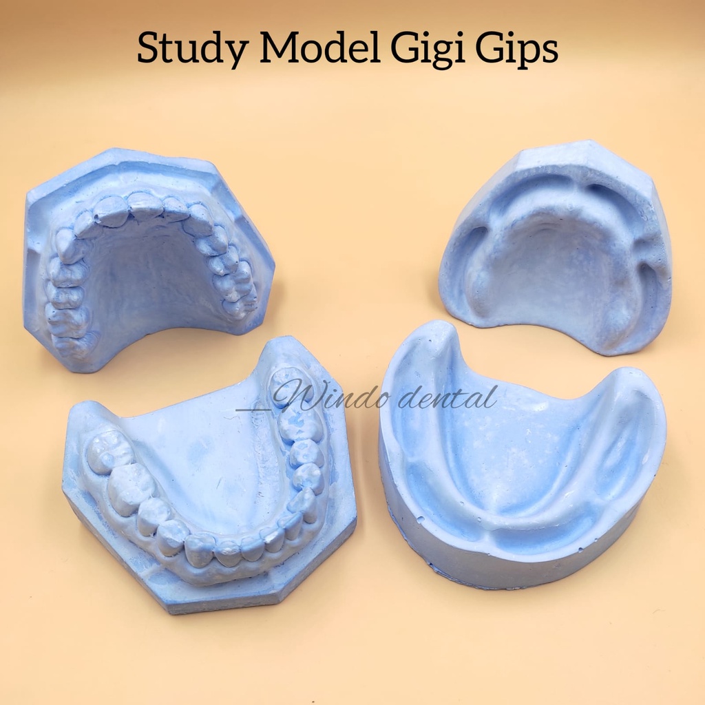 Jual Dental Study Model Gigi Model Gigi Gips Full Rahang Atas Bawah