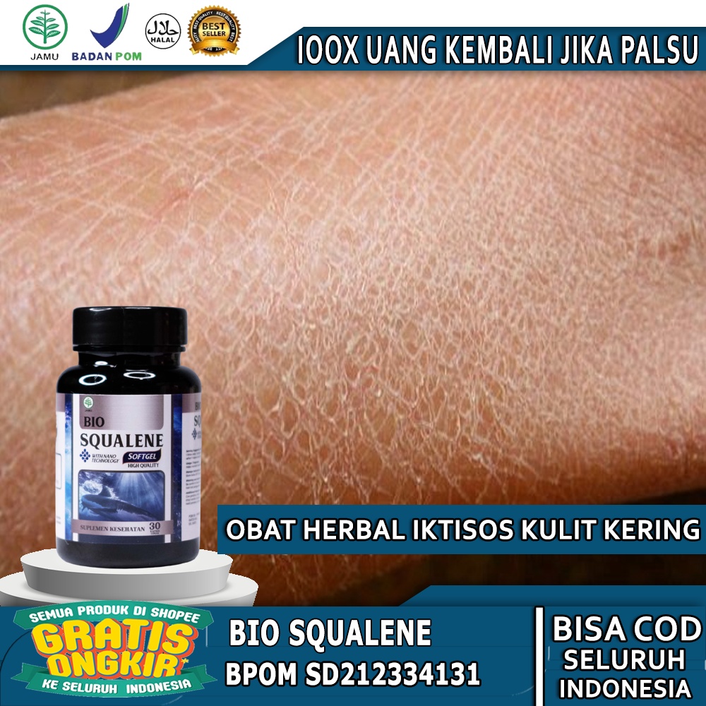 Jual Obat Kulit Iktiosis Obat Kulit Kering Bersisik Menebal Kulit