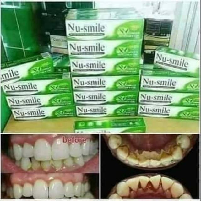 Jual Nu Smile Pasta Gigi Herbal 100 Original HWI Shopee Indonesia