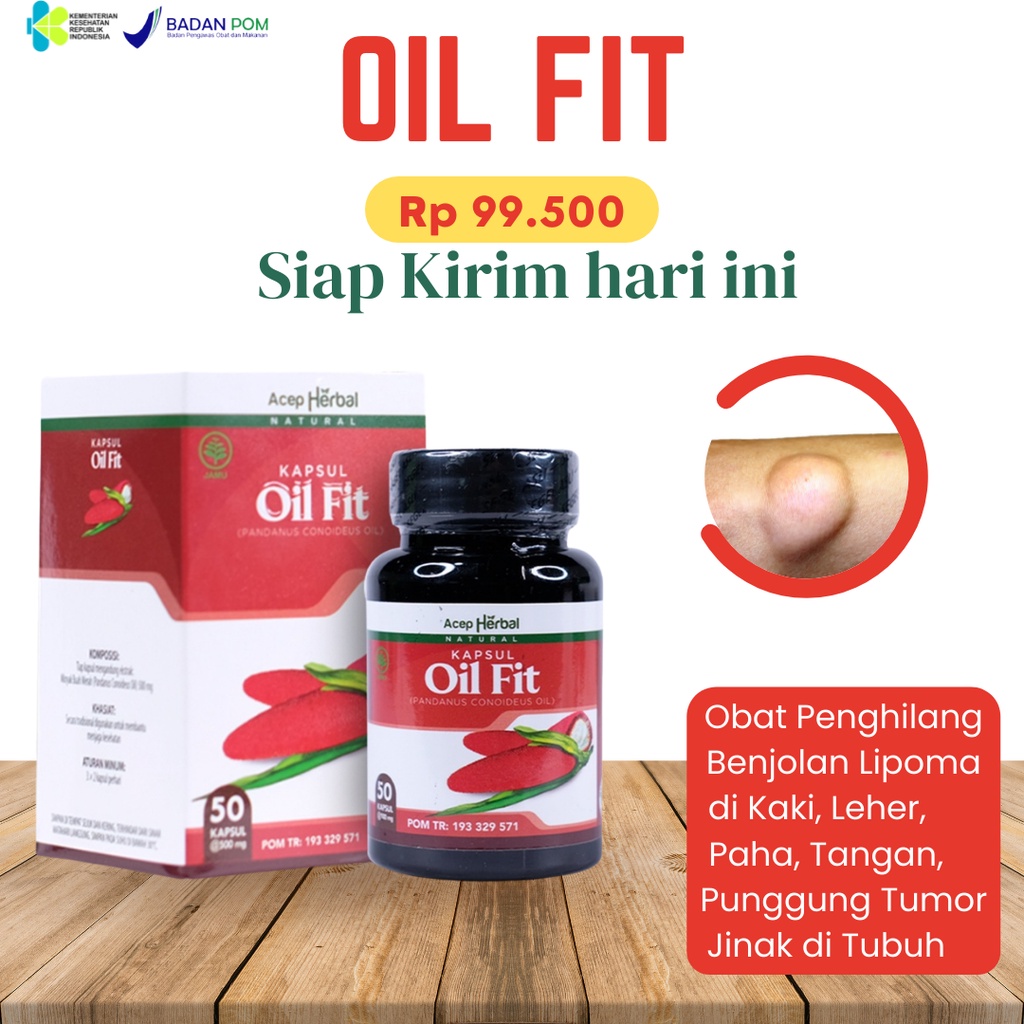 Jual Obat Penghancur Benjolan Lipoma Benjolan Di Leher Uci Uci