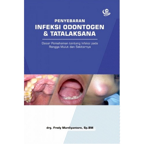 Jual Penyebaran Infeksi Odontogen Dan Tatalaksana Dasar Pemahaman