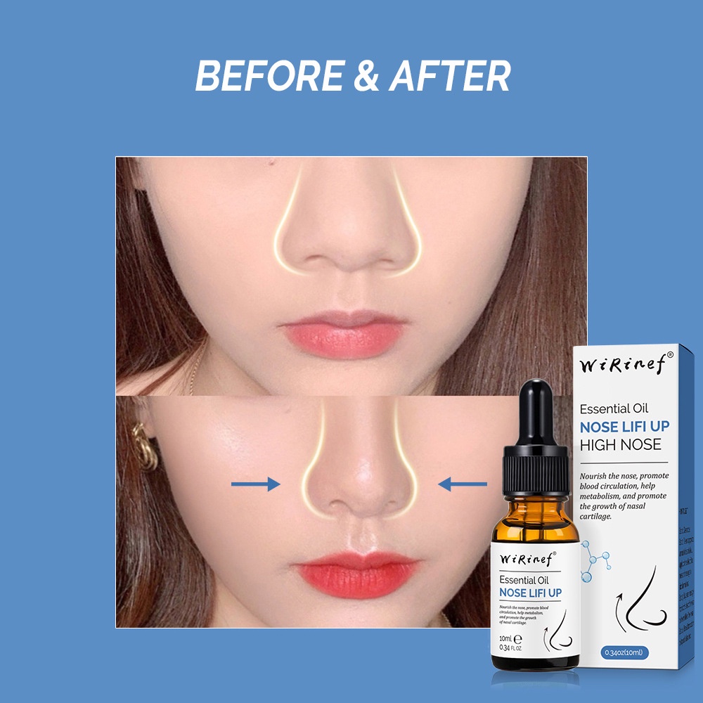 Serum Pemancung Hidung Perumperindo Co Id