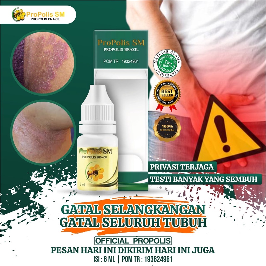 Jual Obat Gatal Di Selangkangan Pria Wanita Selangkangan Gatal Dan