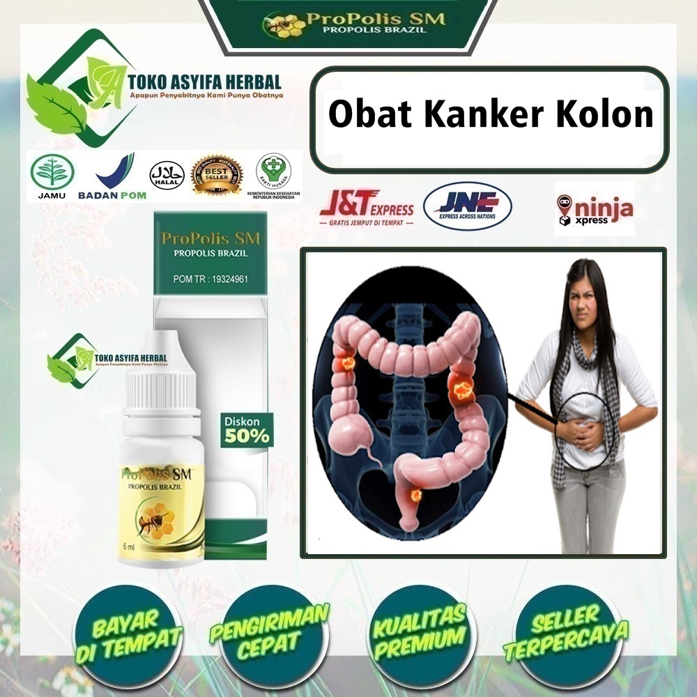 Jual Obat Kanker Kolon Keram Kram Perut Sakit Perut Melilit Kanker