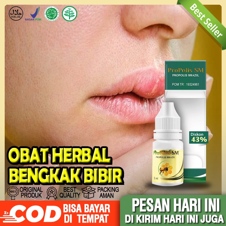 Obat Bibir Bengkak Homecare24