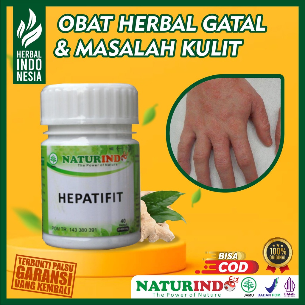 Jual Obat Biduran Gatal Gatal Kulit Alergi Dingin Gatel Ampuh Bintik