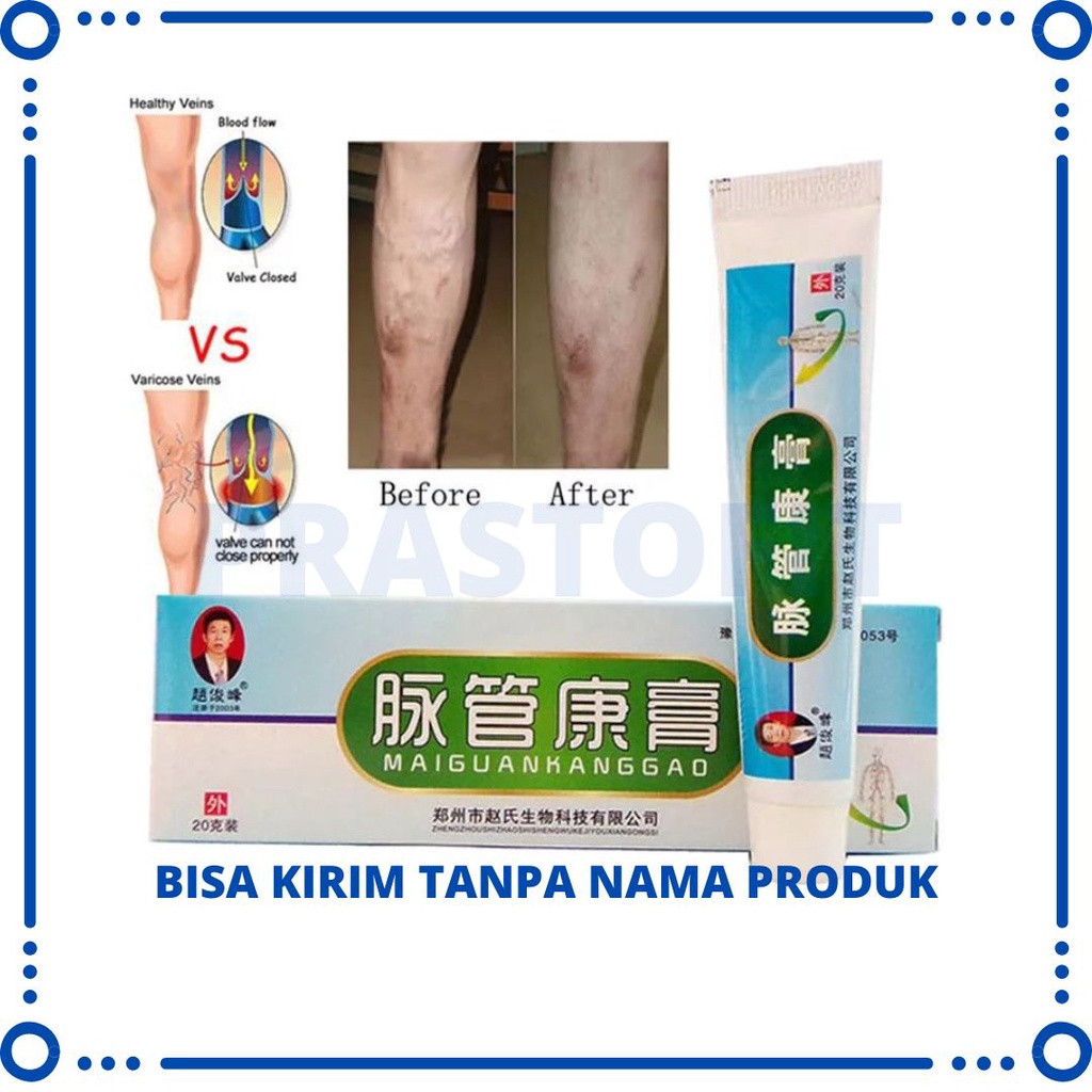 Jual Salep Obat Penghilang Varises Kaki Paling Ampuh Original Varicose