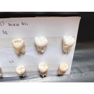 Jual Gigi Molar Rahang Bawah M3 Mirip M1 Shopee Indonesia