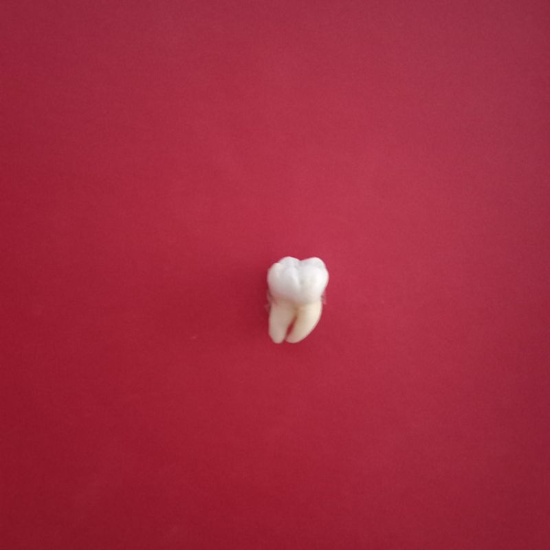 Jual Gigi Molar Geraham Pertama Rahang Atas Bawah Shopee Indonesia