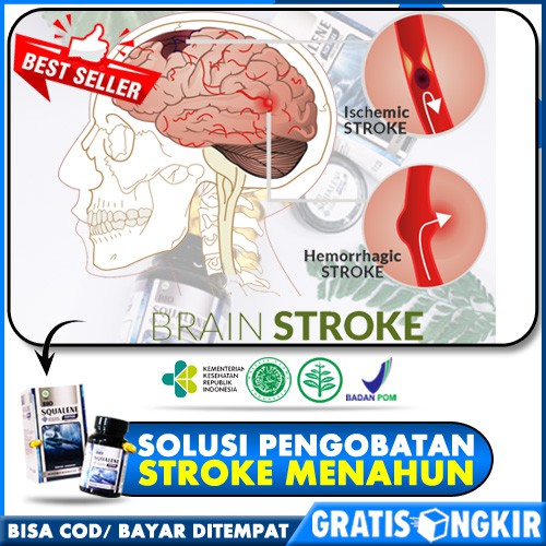 Jual Obat Stroke Ringan Alami Struk Sebelah Setrok Strok Menahun Untuk