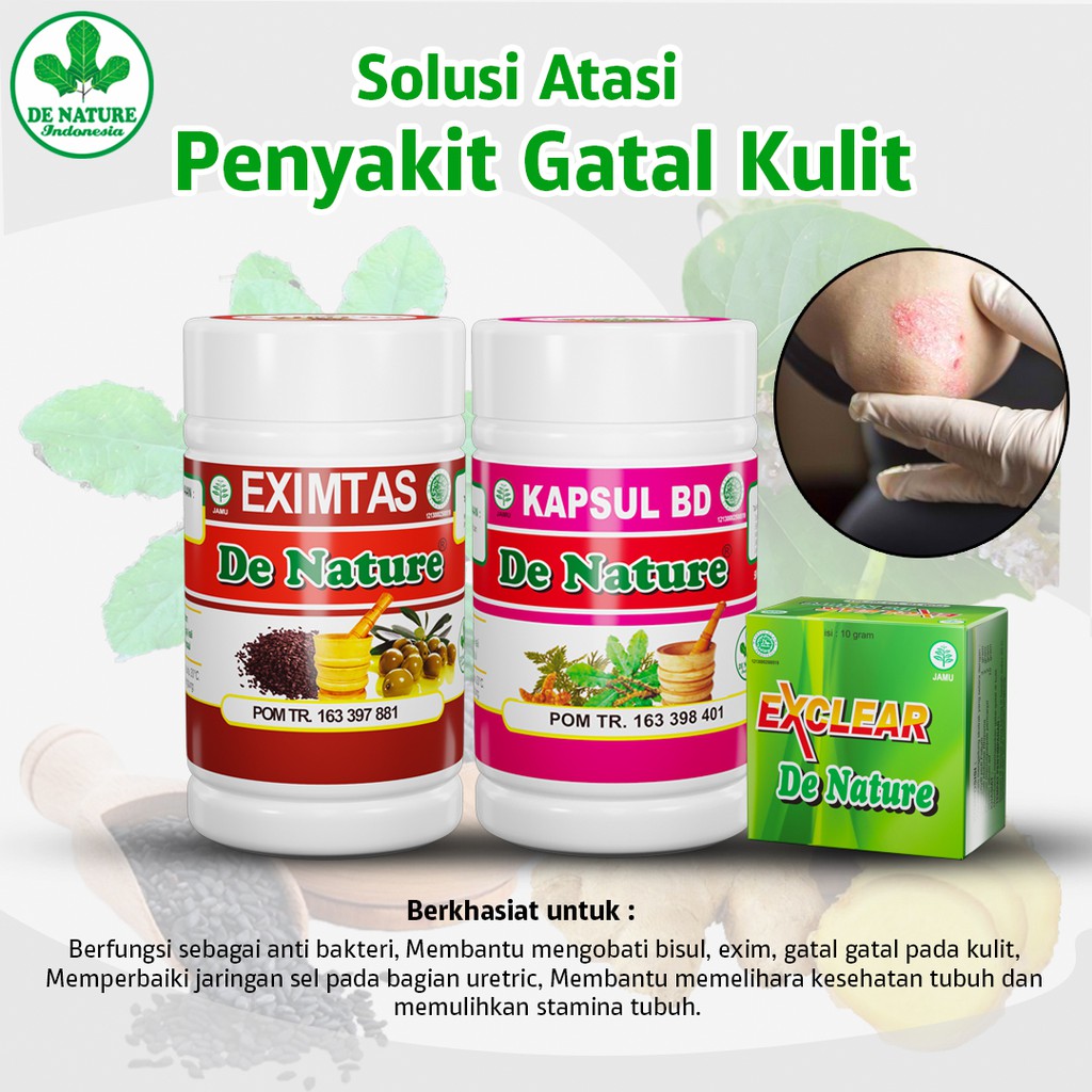 Jual Herbal Penyakit Kulit Kapsul BD Eximtas Dan Salep Exclear