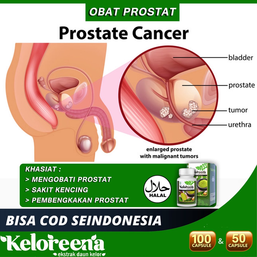 Jual Obat Prostat Bengkak Kanker Obat Cegah Pembesaran Prostat Obat