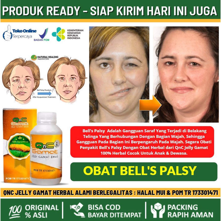 Jual Obat Bellspalsy Bell Palsy Obat Belpasi Obat Otot Lemah Di Muka