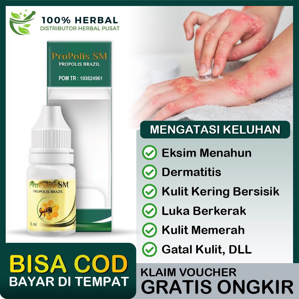 Jual Obat Eksim Kering Basah Gatal Alergi Kulit Kering Bersisik Luka