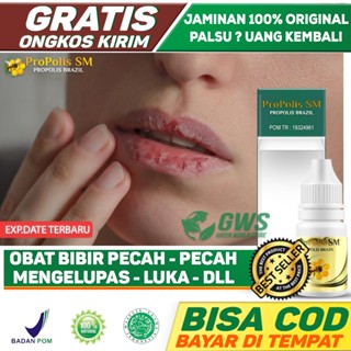 Jual Obat Atasi Bintik Putih Di Bibir Penghilang Fordyce Spots Bercak