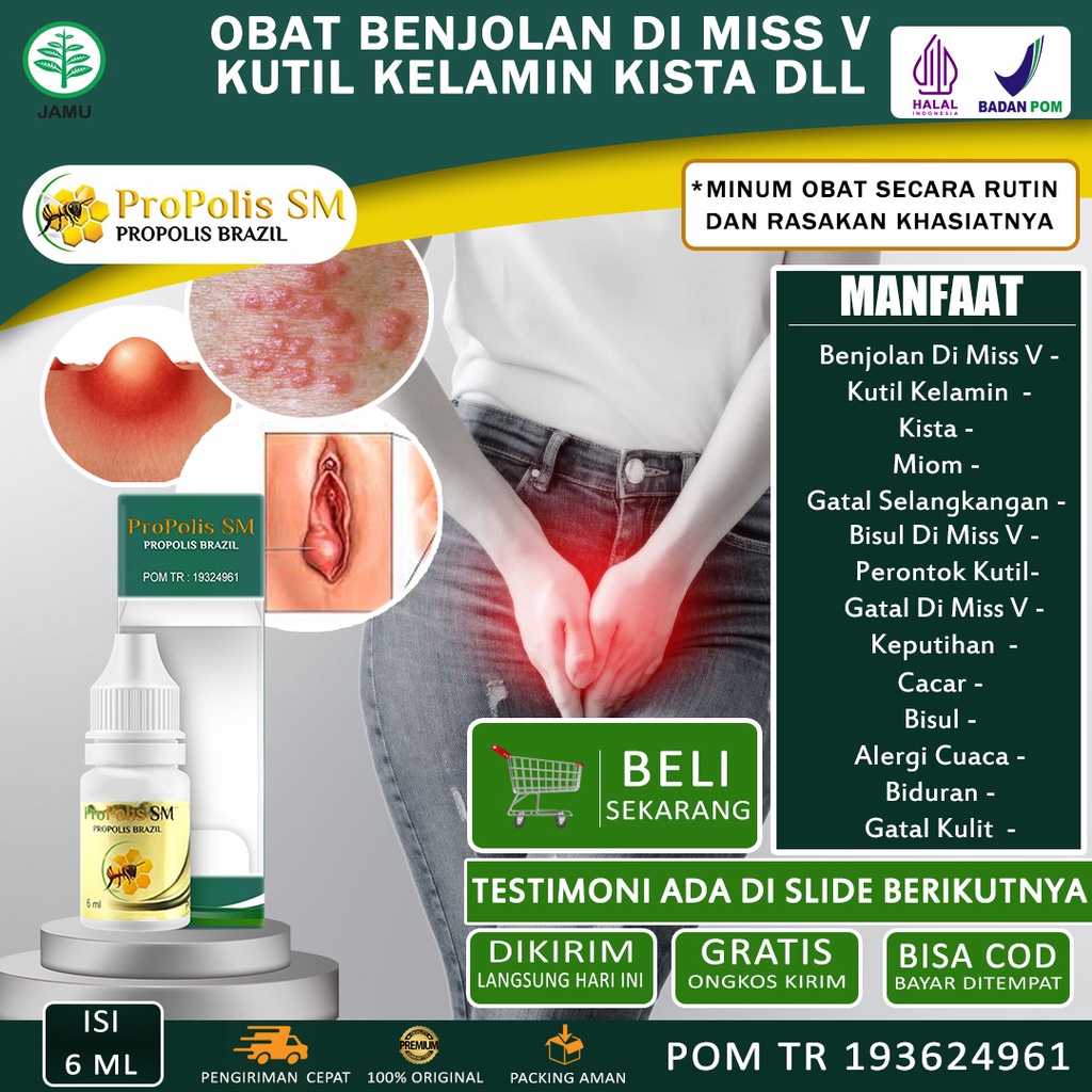 Jual Obat Oles Benjolan Di Miss V Benjolan Vagina Kista Bartholin Miom