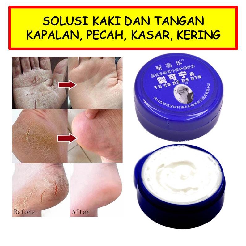 Jual G Krim Herbal Menghaluskan Melembutkan Kaki Dan Tangan Kapalan