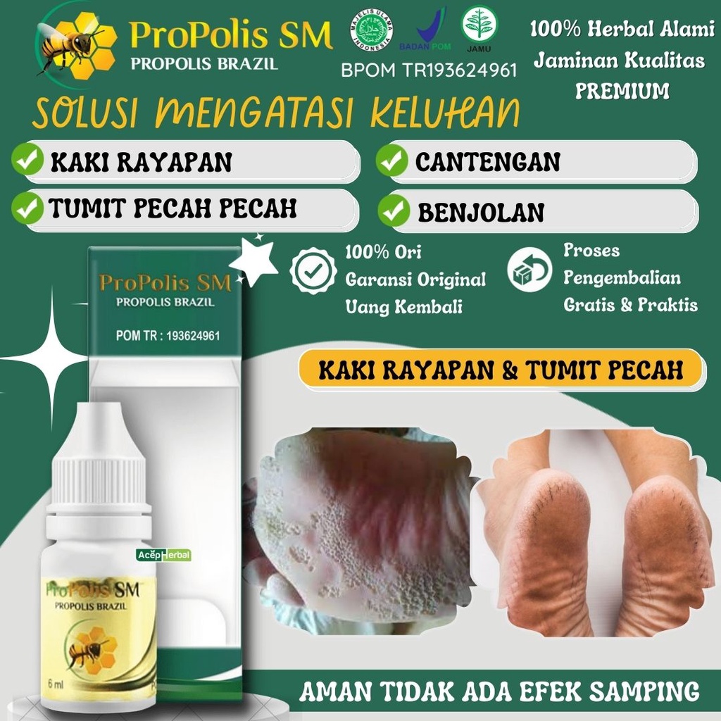 Jual Obat Tetes Kaki Rayapan Berbau Kutu Air Kering Telapak Kaki