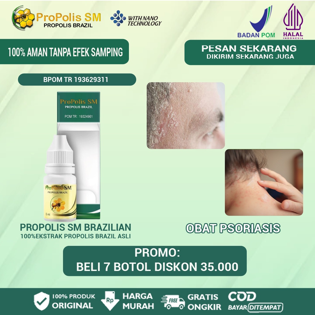 Jual Propolis SM Brazilian With Nano Technology Obat Psoriasis Kulit