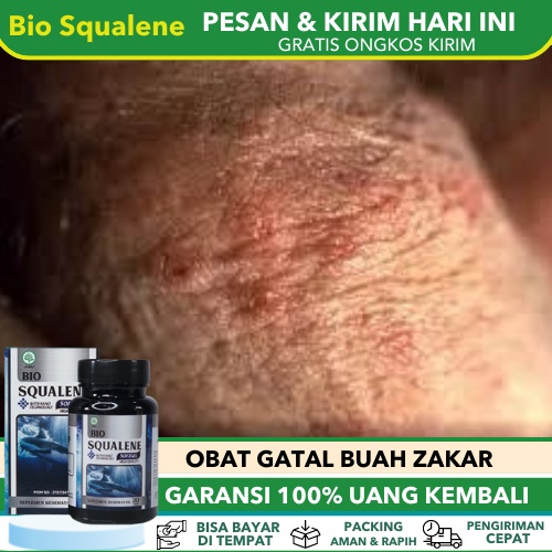 Jual Obat Gatal Kulit Buah Zakar Obat Kulit Testis Gatal Obat Kulit