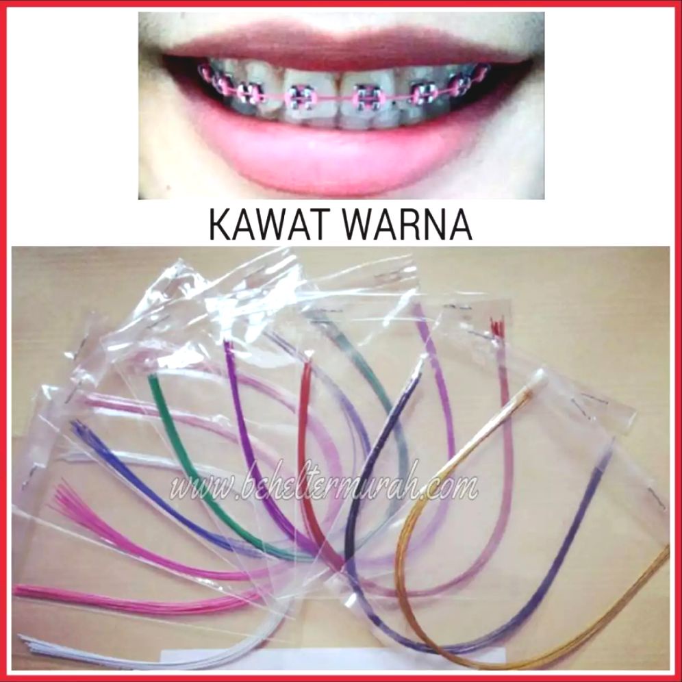 Jual Kawat Niti Warna Behel Per Pack Mix Isi Pcs Kawat Behel