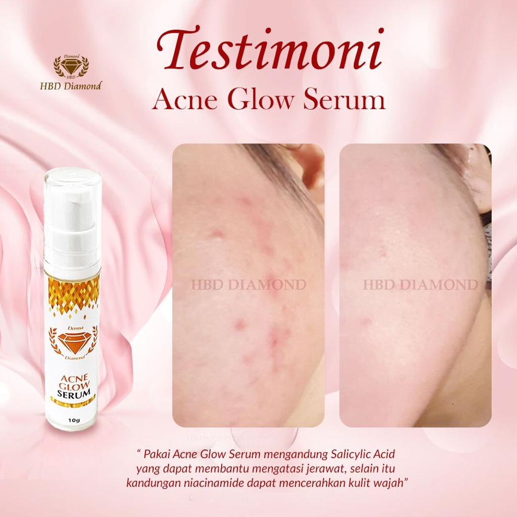 Jual Serum Acne Glow Hbd Diamond Anti Acne Serum Bpom Serum Untuk Kulit