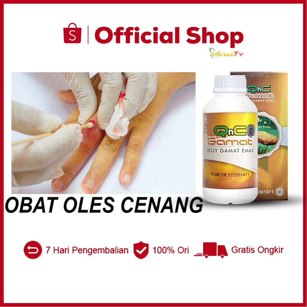 Jual Obat Oles Cenang Bernanah Budug Bernanah Budug Santri Budug Di