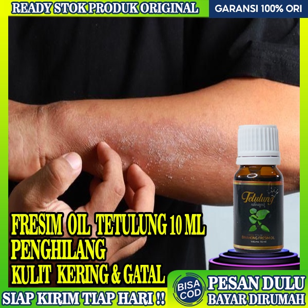 Jual Obat Kulit Kering Dan Gatal Obat Jari Tangan Kering Fresim Oil