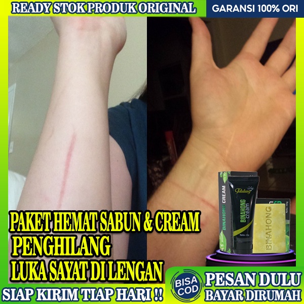 Jual Paket Bundling Cream Binahong Dan Sabun Obat Luka Sayat Obat Cream